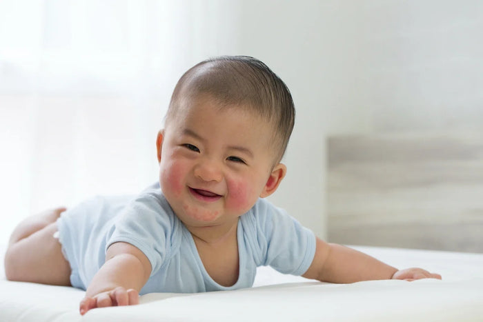 bébé avec des boutons sur les joues